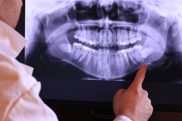 Best Emergency Dental Care for Trauma or Injury in Blue Ridge, TX