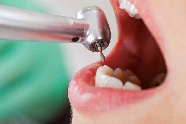  Blue Ridge, TX Emergency Dentist Pros